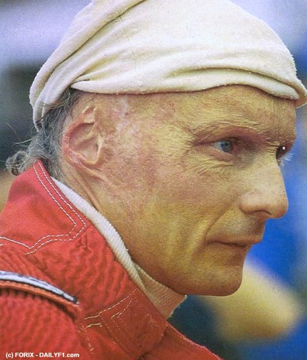 Drei Titel für Österreich in den 70'ern - zwei davon steuerte Niki Lauda bei.